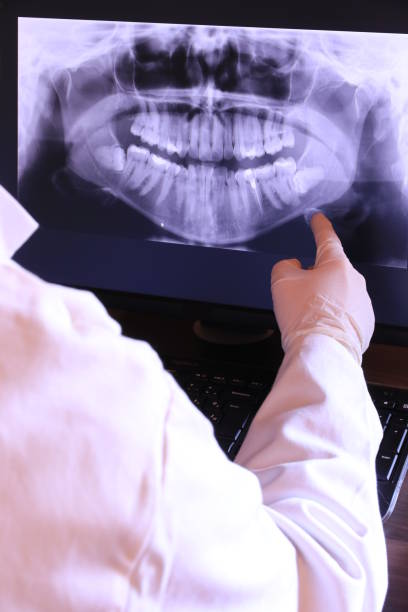 Best Emergency Denture Repair in New Bedford, MA