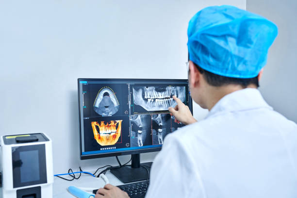 Best Dental Abscess Treatment in New Bedford, MA