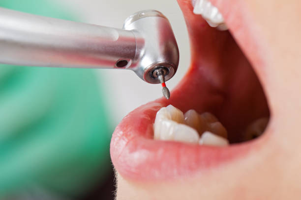 Best Emergency Cosmetic Dentistry (e.g., broken veneers) in New Bedford, MA